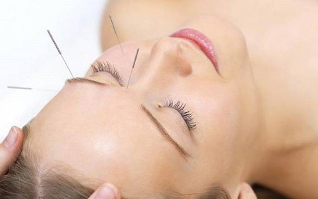 L'acupuncture pour maigrir : est-ce que ça marche vraiment ?